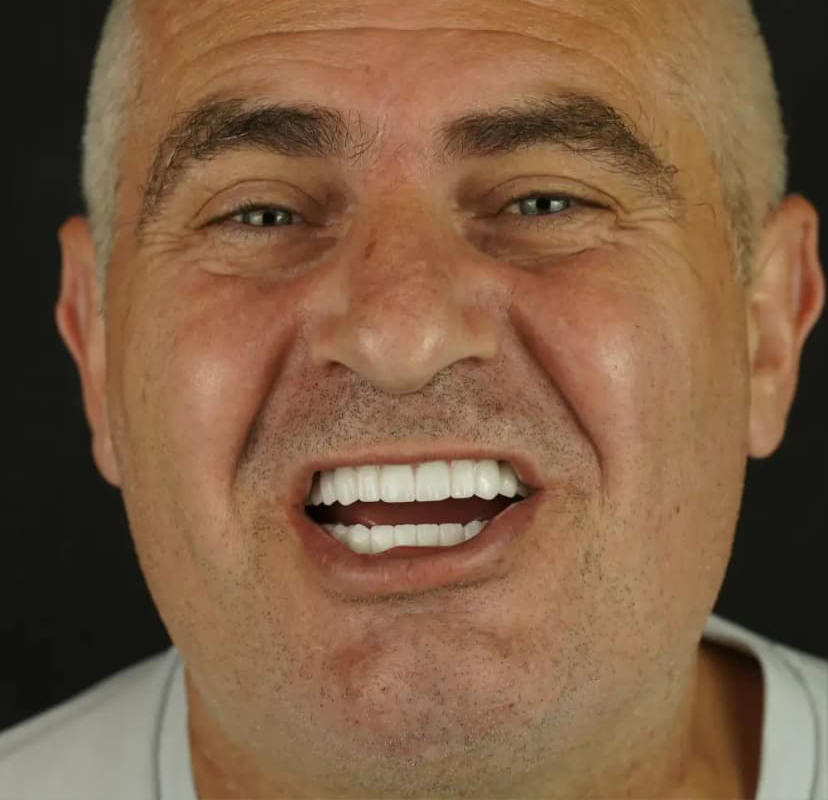 Tedavi sonrası